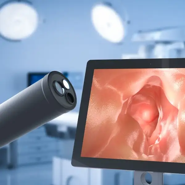 esophagus testing ky