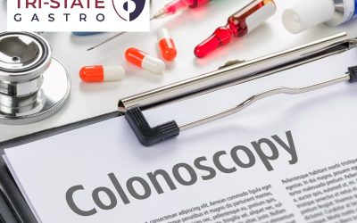 Why Your Doctor Wants You to Get a Colonoscopy