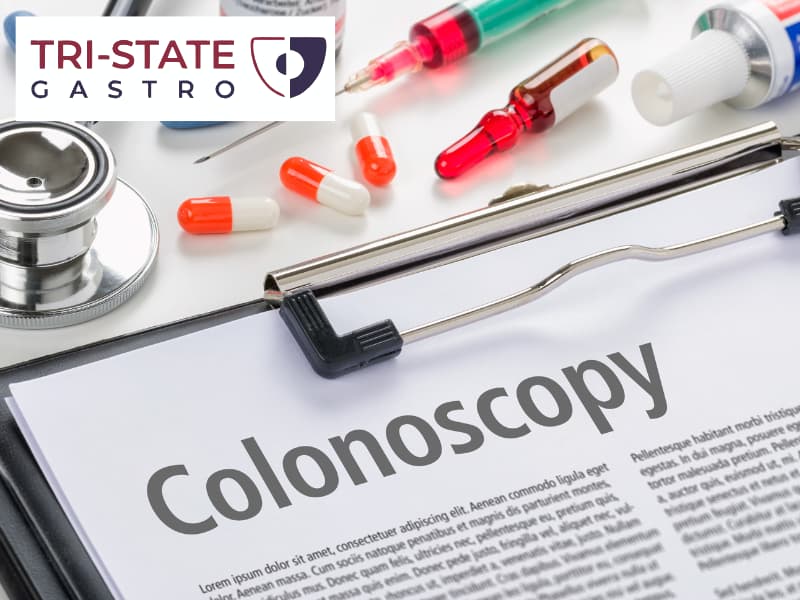 Why Your Doctor Wants You to Get a Colonoscopy