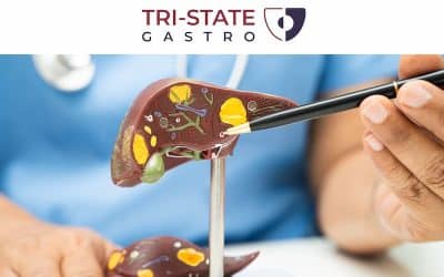 6 Things You Should Not Do After Liver Surgery