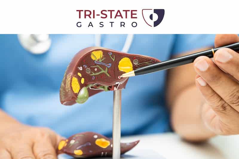 6 Things You Should Not Do After Liver Surgery