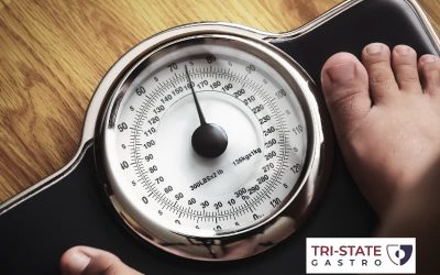 Role of the Gut Microbiome in Weight Management
