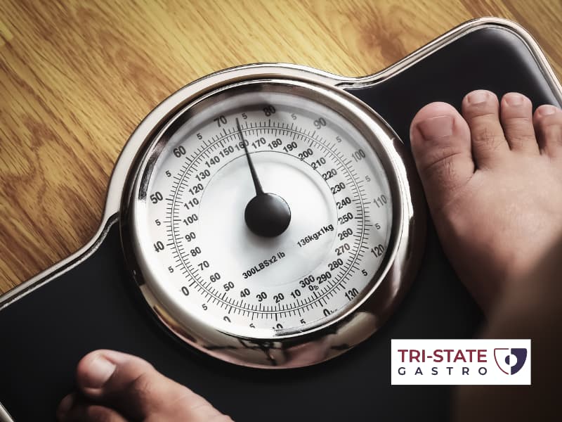 Gut Microbiome in Weight Management
