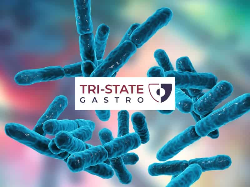Probiotics and Digestive Health: The Benefits of Good Bacteria