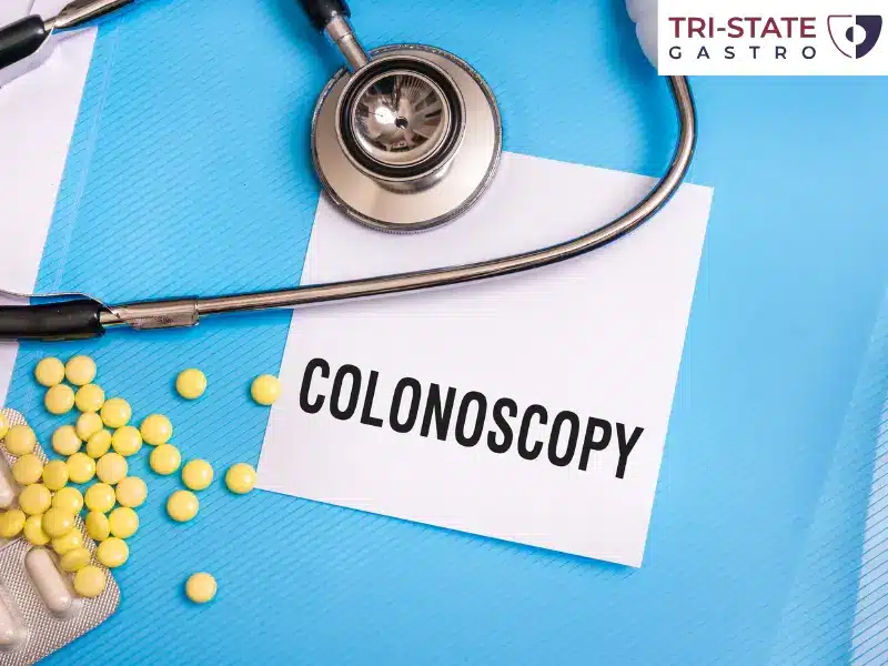 Why It is Important to Get Your Colonoscopy