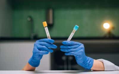Bravo pH Probe Test Everything You Need to Know Before Your Appointment